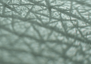 Osocze bogatopłytkowe