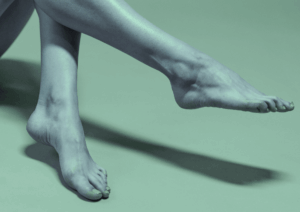 Skleroterapia – zamykanie naczyń